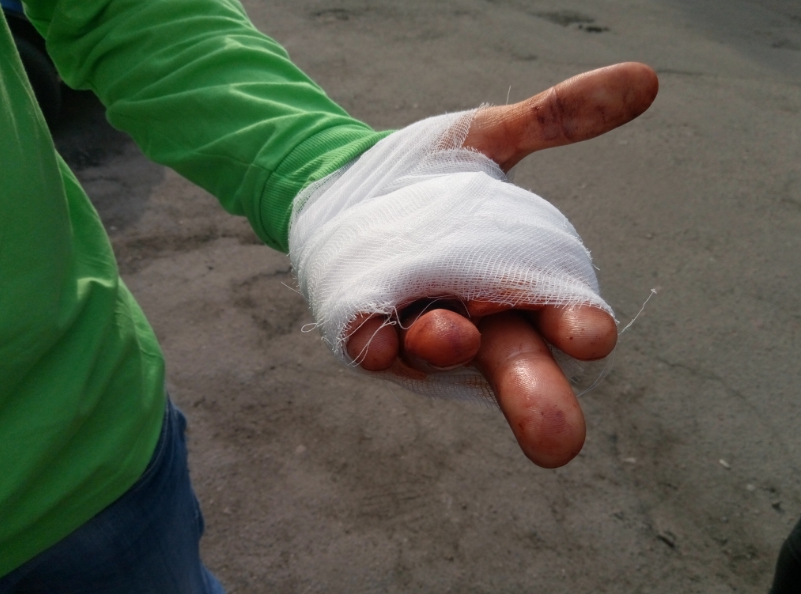 Земельные войны в Ирпене: на месте сквера титушки избили и порезали активистов (ФОТО)