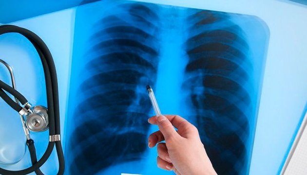 В Украине зарегистрировали инновационное лекарство против туберкулеза