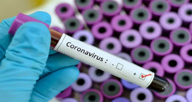 В Киеве зафиксировано два случая коронавируса 